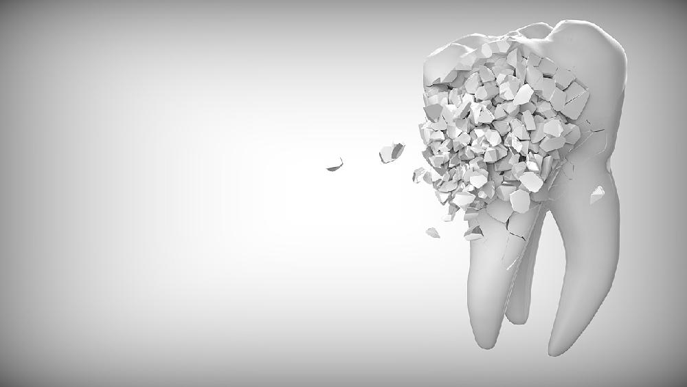 Kiedy stomatolog zaleci rentgen zęba?