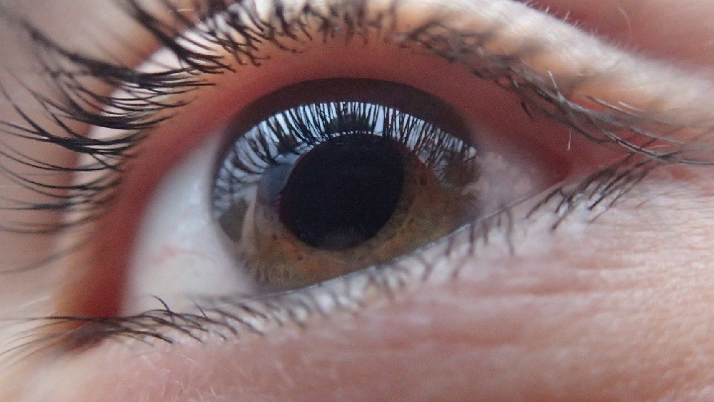 Stożek rogówki: choroba oczu młodych osób