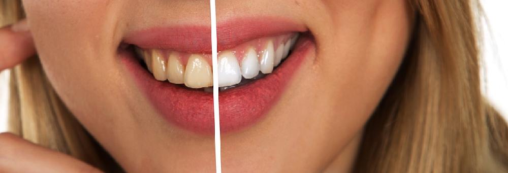Kiedy stomatolog zaleci rentgen zęba?